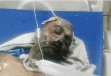 राज्य के बड़े सरकारी SMS हॉस्पिटल में भीषण आग: ट्रॉमा सेंटर ICU में शॉर्ट सर्किट से लगी आग, 8 मरीजों की मौत, कई की हालत गंभीर