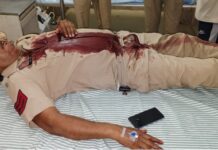 मोगा में 112 PCR टीम पर हमला: DJ बंद कराने पहुंची पुलिस पर बरसे ईंट-पत्थर, हवलदार गंभीर घायल